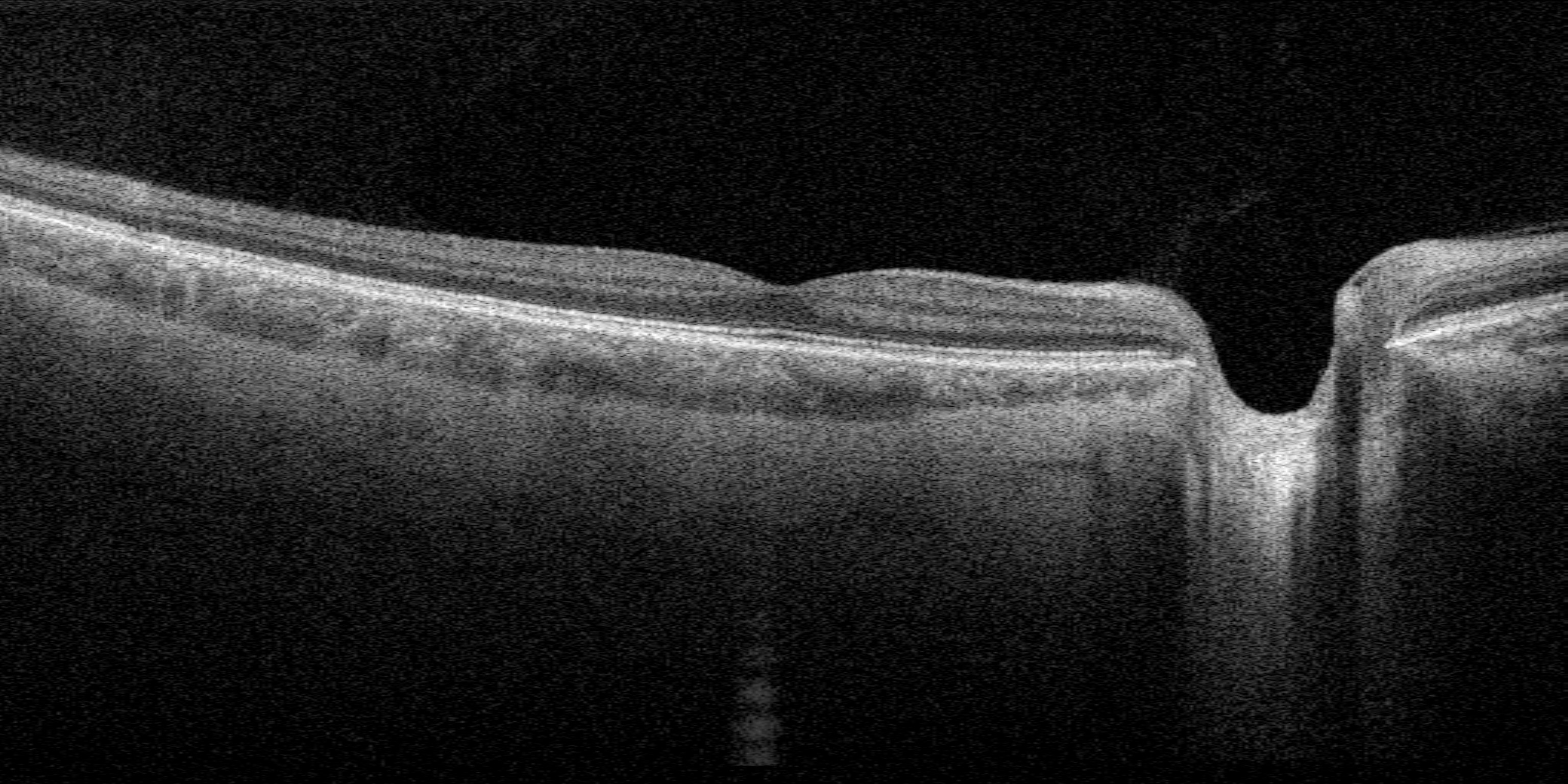 Abbildung der Netzhaut des Auges